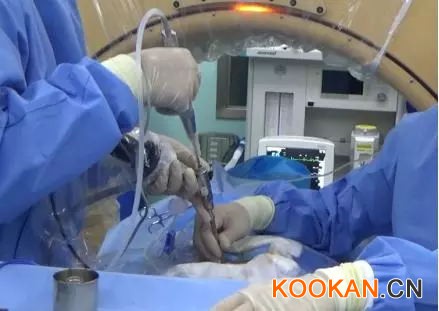 水木天蓬超聲骨刀，把手術變簡單，把時間還給醫生