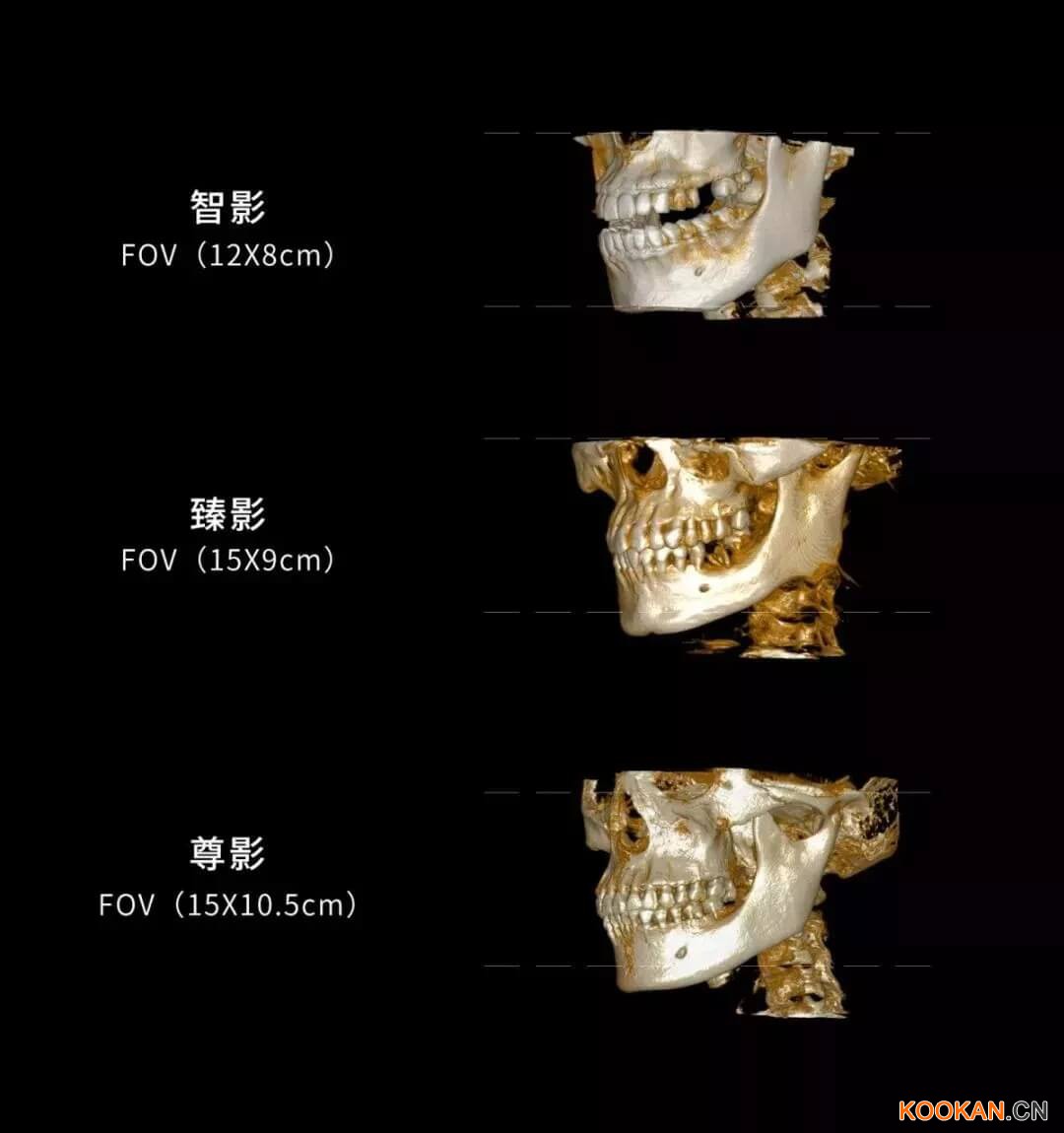 采購口腔CBCT，多大的視野比較好