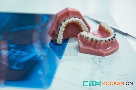 口腔行業(yè)開(kāi)啟千億級(jí)市場(chǎng)，正畸醫(yī)生緊缺