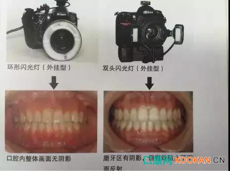 拍不好口腔照片怎么辦？這些口腔攝影方法與技巧請收好！