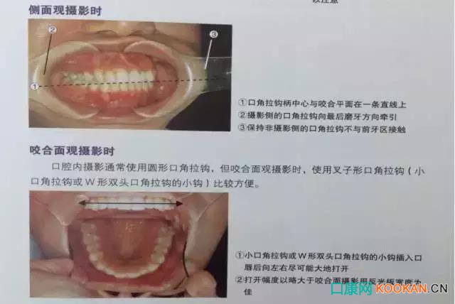 拍不好口腔照片怎么辦？這些口腔攝影方法與技巧請收好！