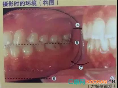 拍不好口腔照片怎么辦？這些口腔攝影方法與技巧請收好！
