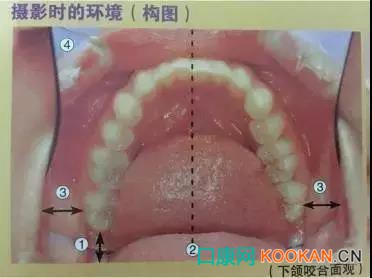 拍不好口腔照片怎么辦？這些口腔攝影方法與技巧請收好！