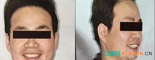 拍不好口腔照片怎么辦？這些口腔攝影方法與技巧請收好！