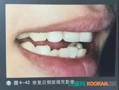 拍不好口腔照片怎么辦？這些口腔攝影方法與技巧請收好！