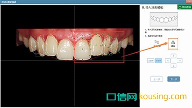 DSD美學設計口腔管理軟件鏡像工具實現高效化調整